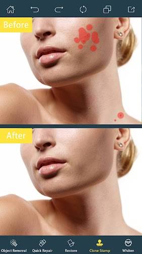 Photo Retouch- Object Removal ဖန်သားပြင်ဓာတ်ပုံ 1