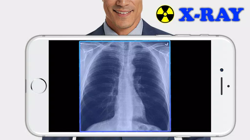 X-Ray Filter Photo Screenshot 0