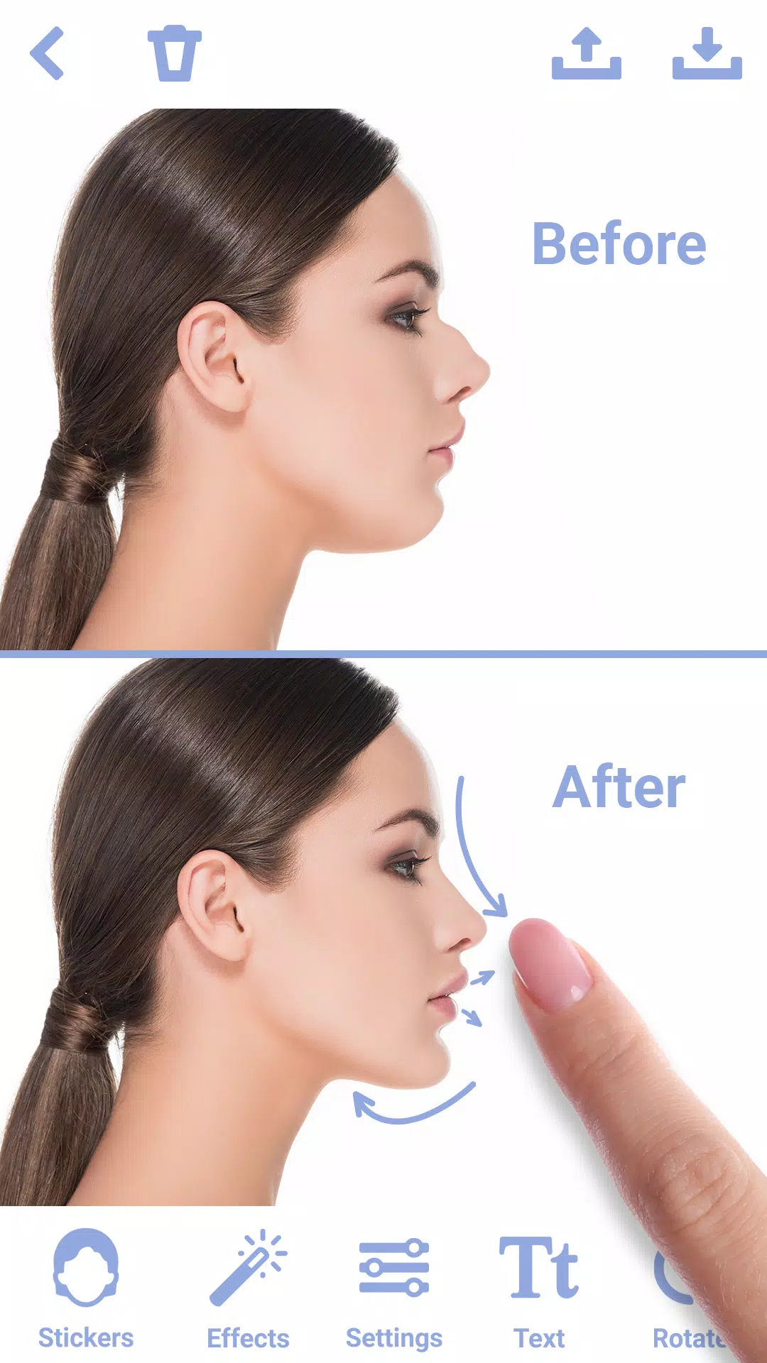 Rhinoplasty ဖန်သားပြင်ဓာတ်ပုံ 0